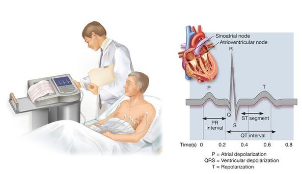 Elektrocardiografie om cardiovasculaire aandoeningen te detecteren met hypertensie